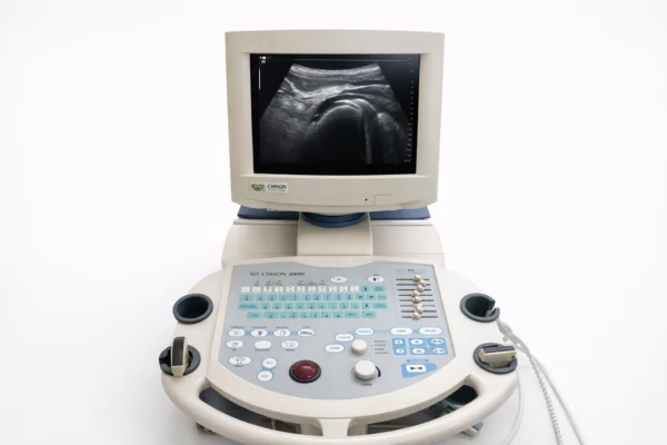 διαγνωστικός υπέρηχος