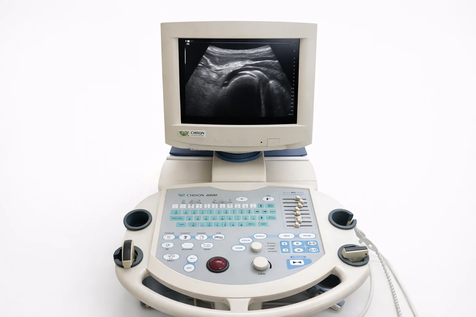 διαγνωστικός υπέρηχος